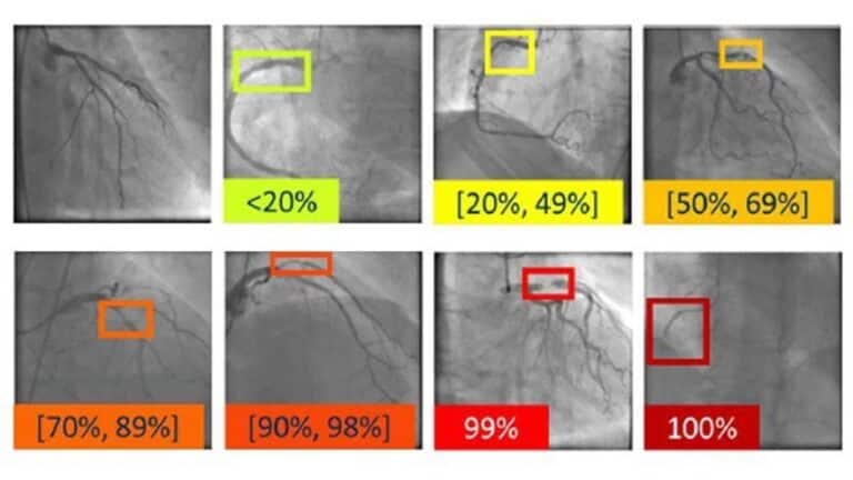 Recopilan más de 6.000 imágenes para apoyar el diagnóstico de enfermedades cardiovasculares